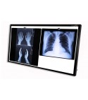 Negatoscopios LED Doble Ultra delgados
